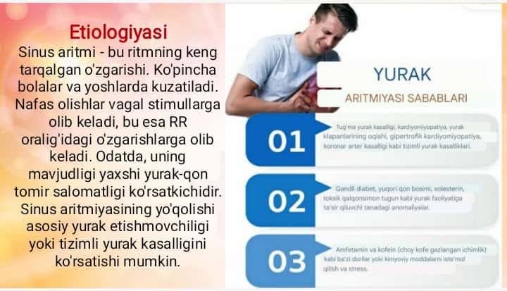 Sinus aritmiya ppt