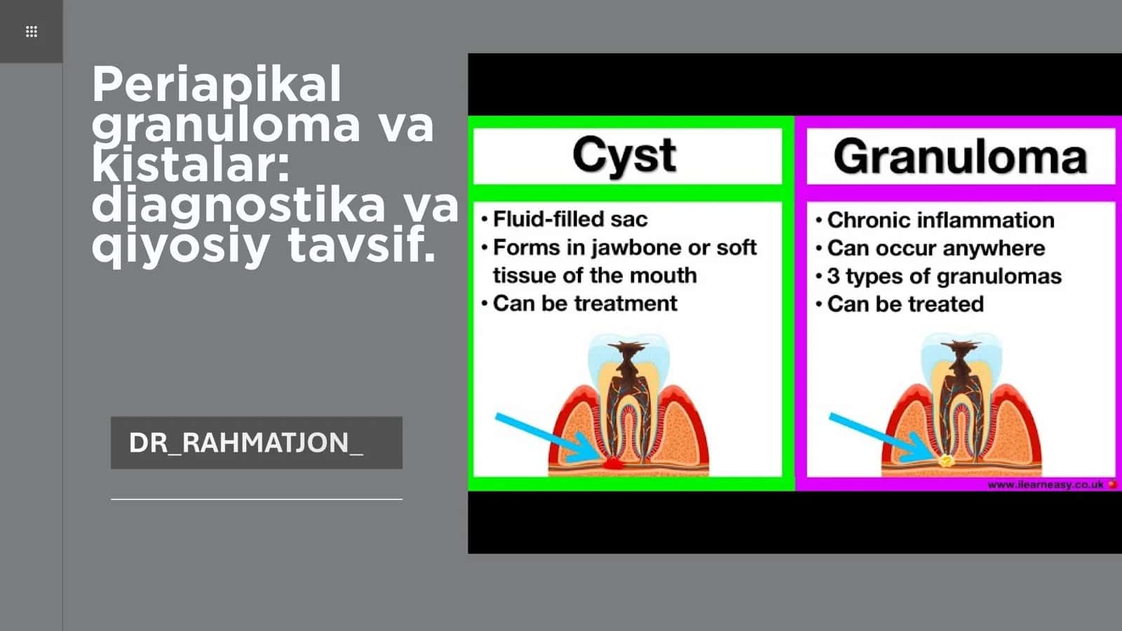 Periapikal granuloma va kistalar: diagnostika va qiyosiy tavsif