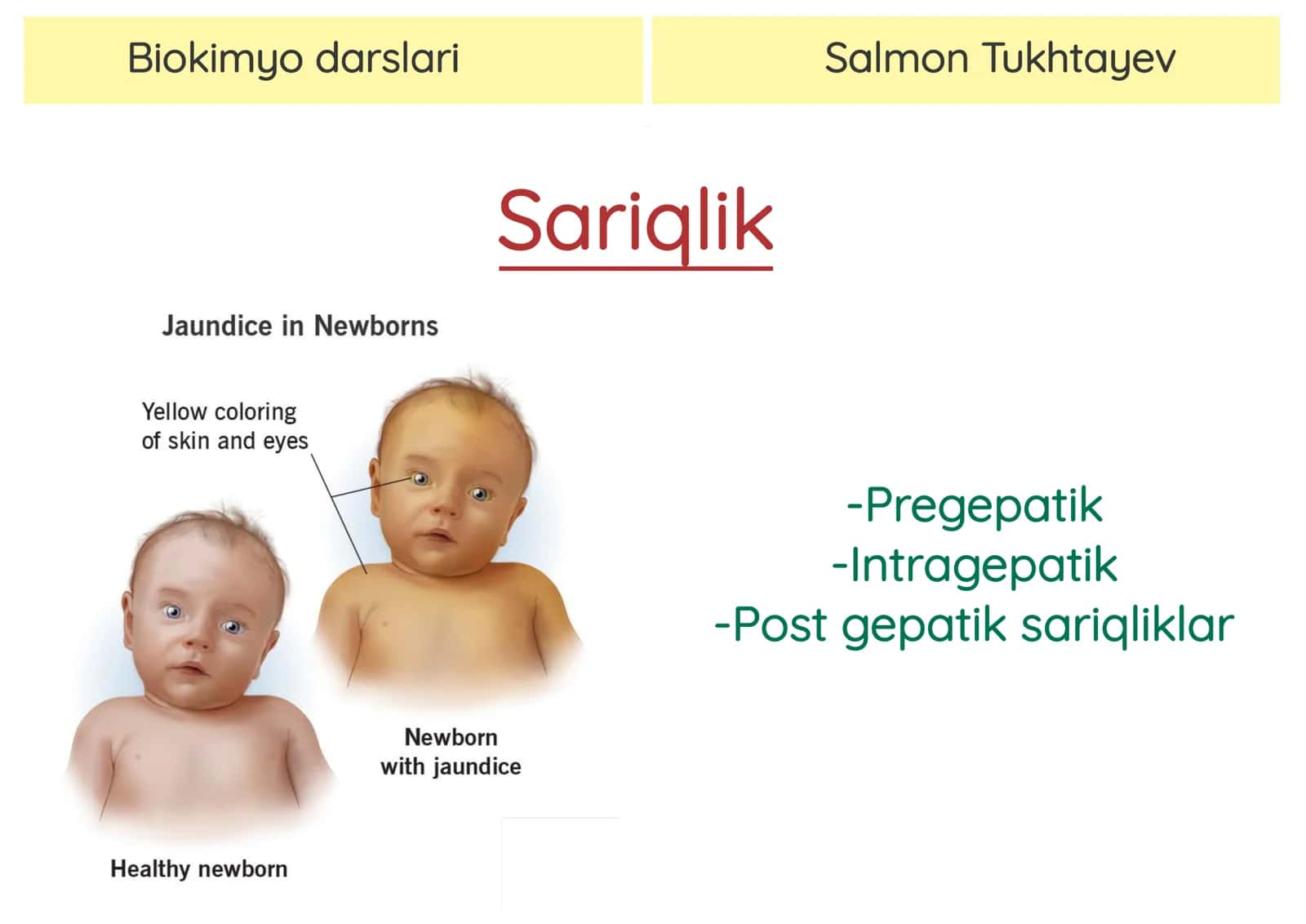 Sariqlik