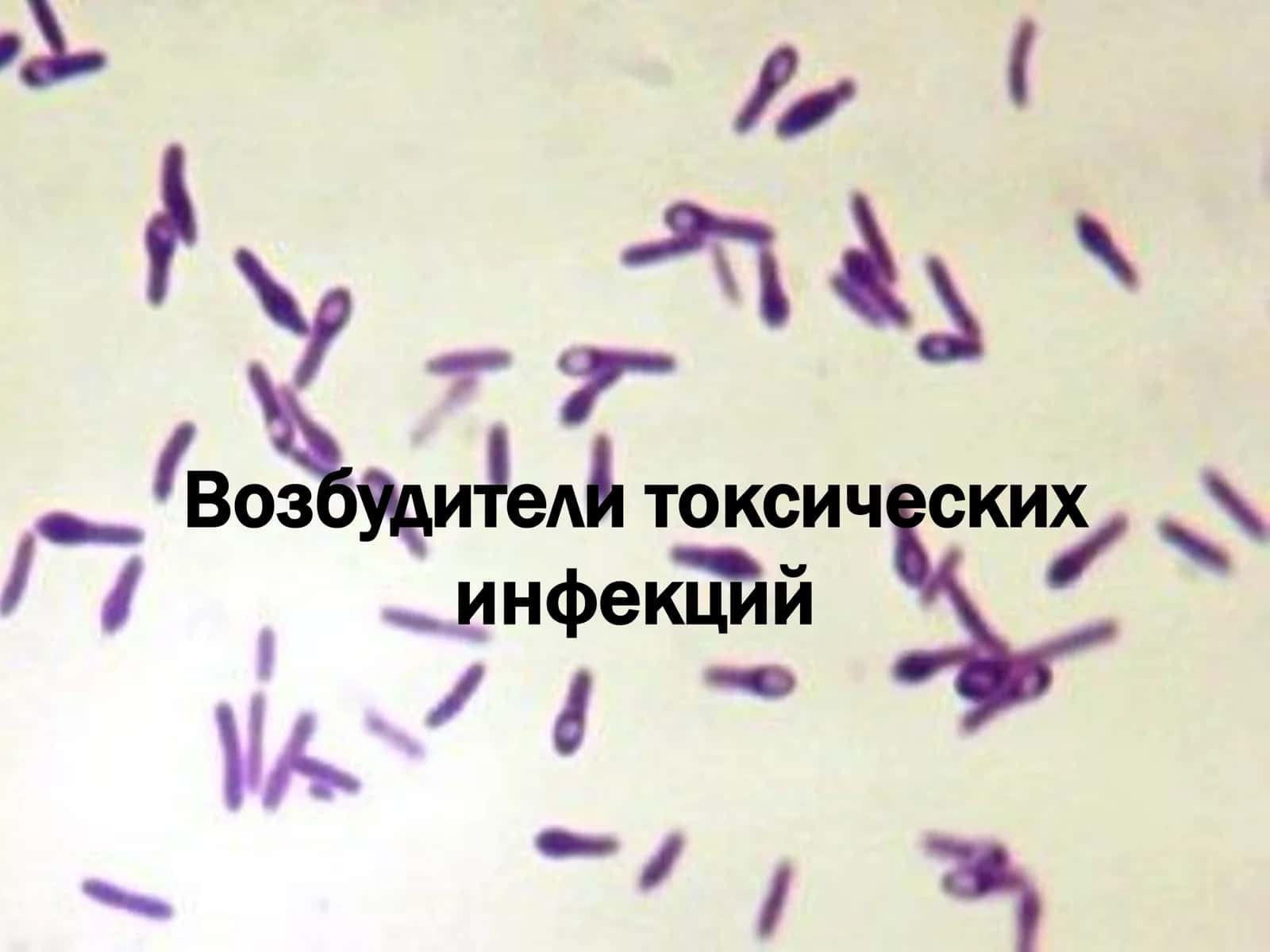 Возбудители токсических инфекций