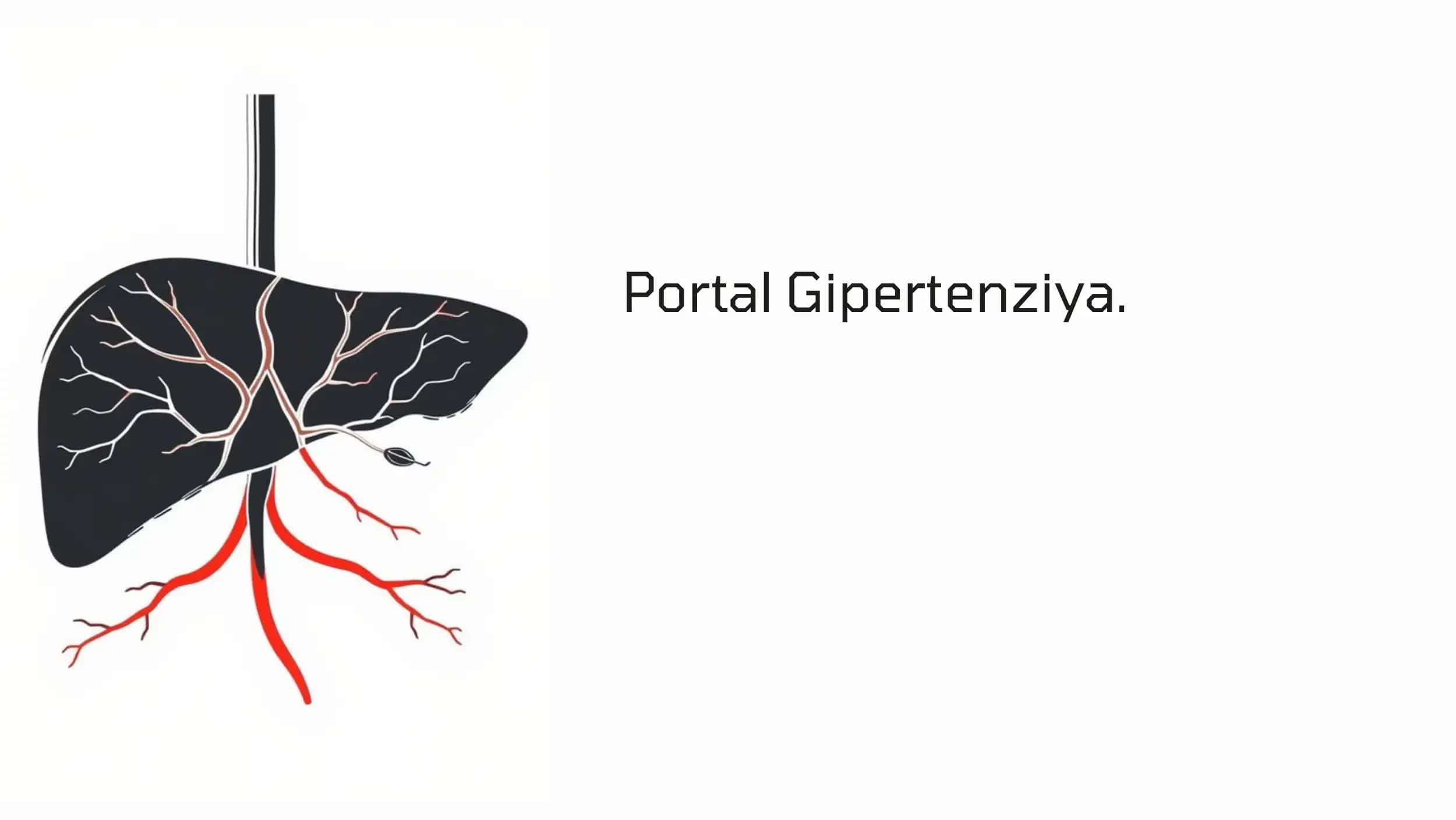 Portal Gipertenziya