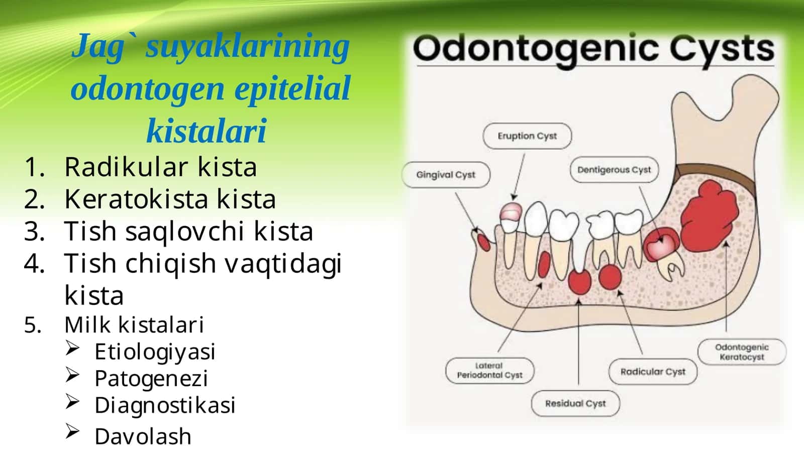 Jag` suyaklarining odontogen epitelial kistalari