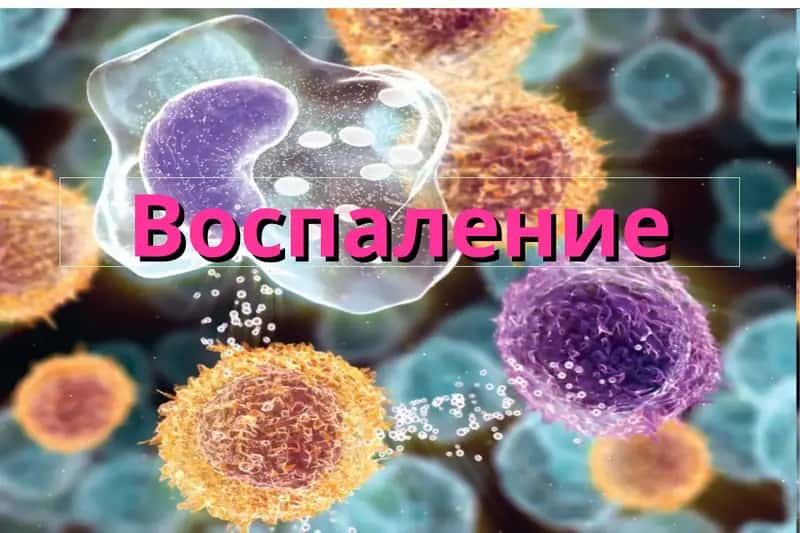 Воспаление