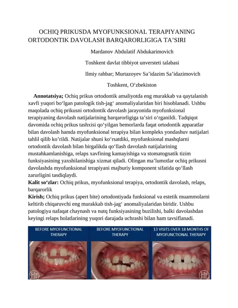 OCHIQ PRIKUSDA MYOFUNKSIONAL TERAPIYANING ORTODONTIK DAVOLASH BARQARORLIGIGA TA’SIRI