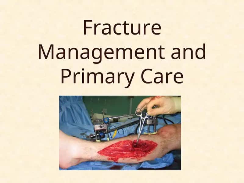 Fracture Management and Primary Care