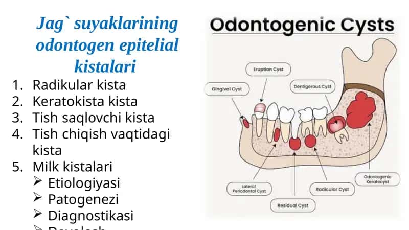 Jag` suyaklarining odontogen epitelial kistalari