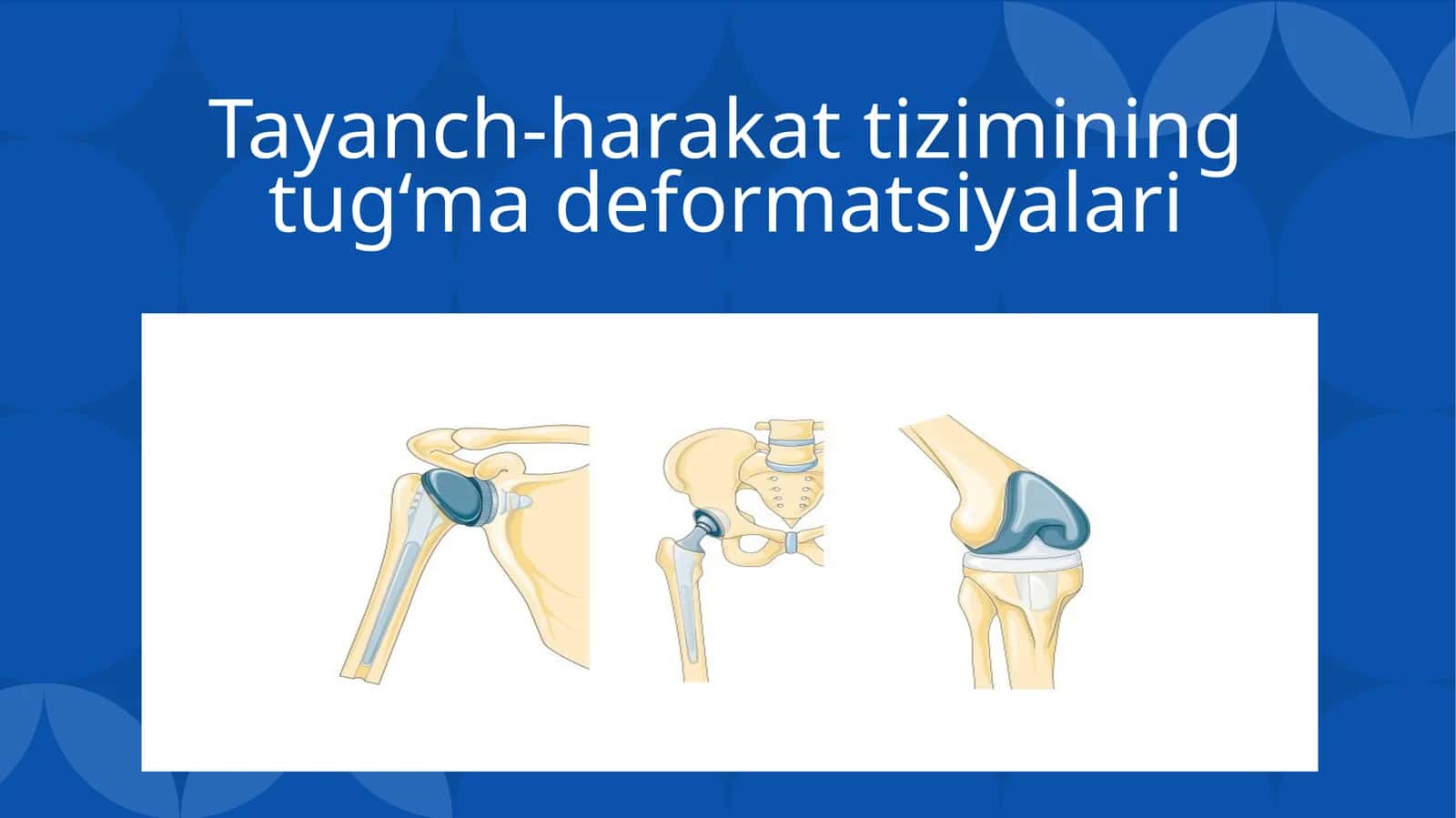 Tayanch-harakat tizimining tug‘ma deformatsiyalari