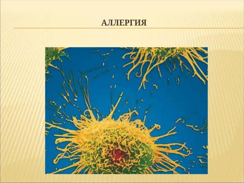 АЛЛЕРГИЯ