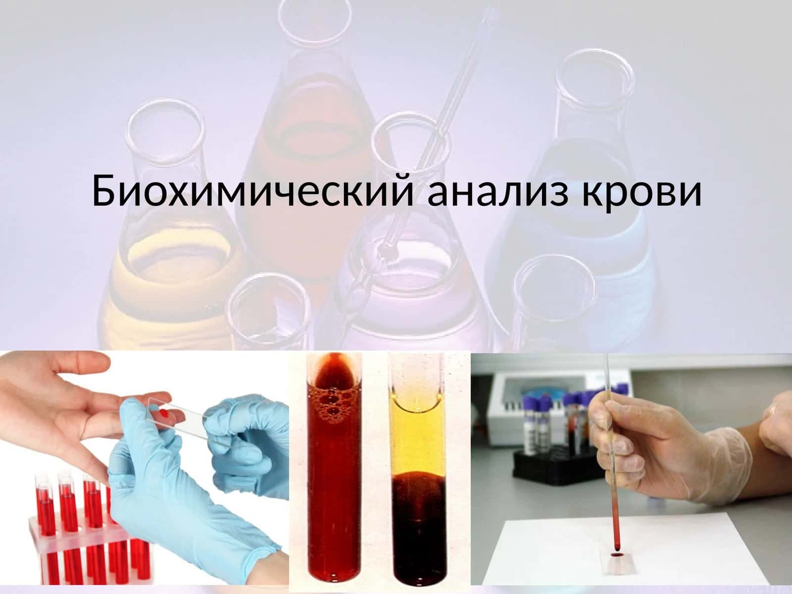 Биохимический анализ крови