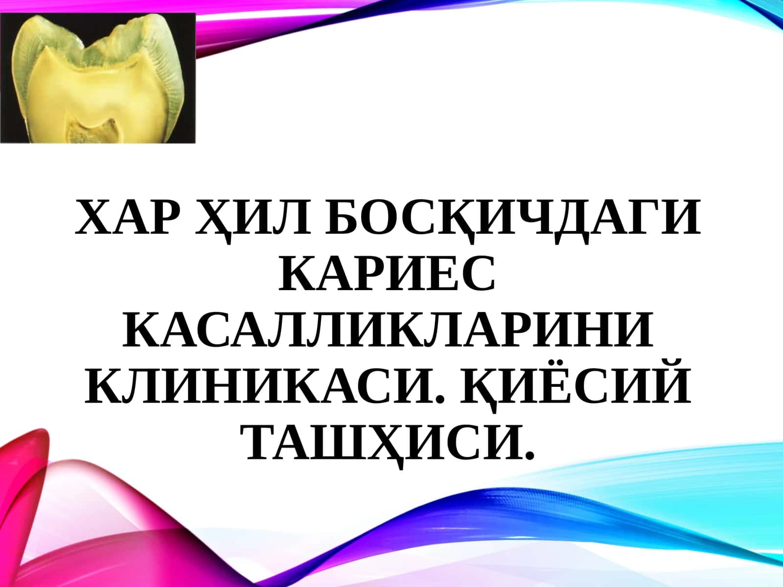 Хар ҳил босқичдаги кариес касалликларини клиникаси. Қиёсий ташҳиси.