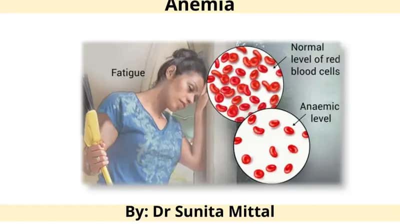 Anemia