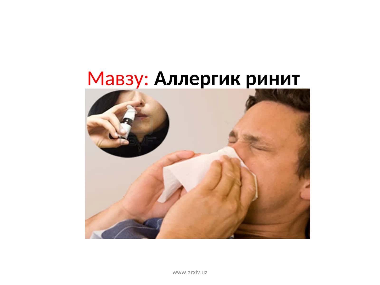 Аллергик ринит