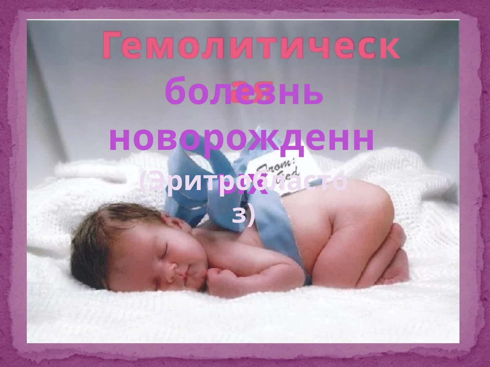 Гемолитическая болезнь новорожденных