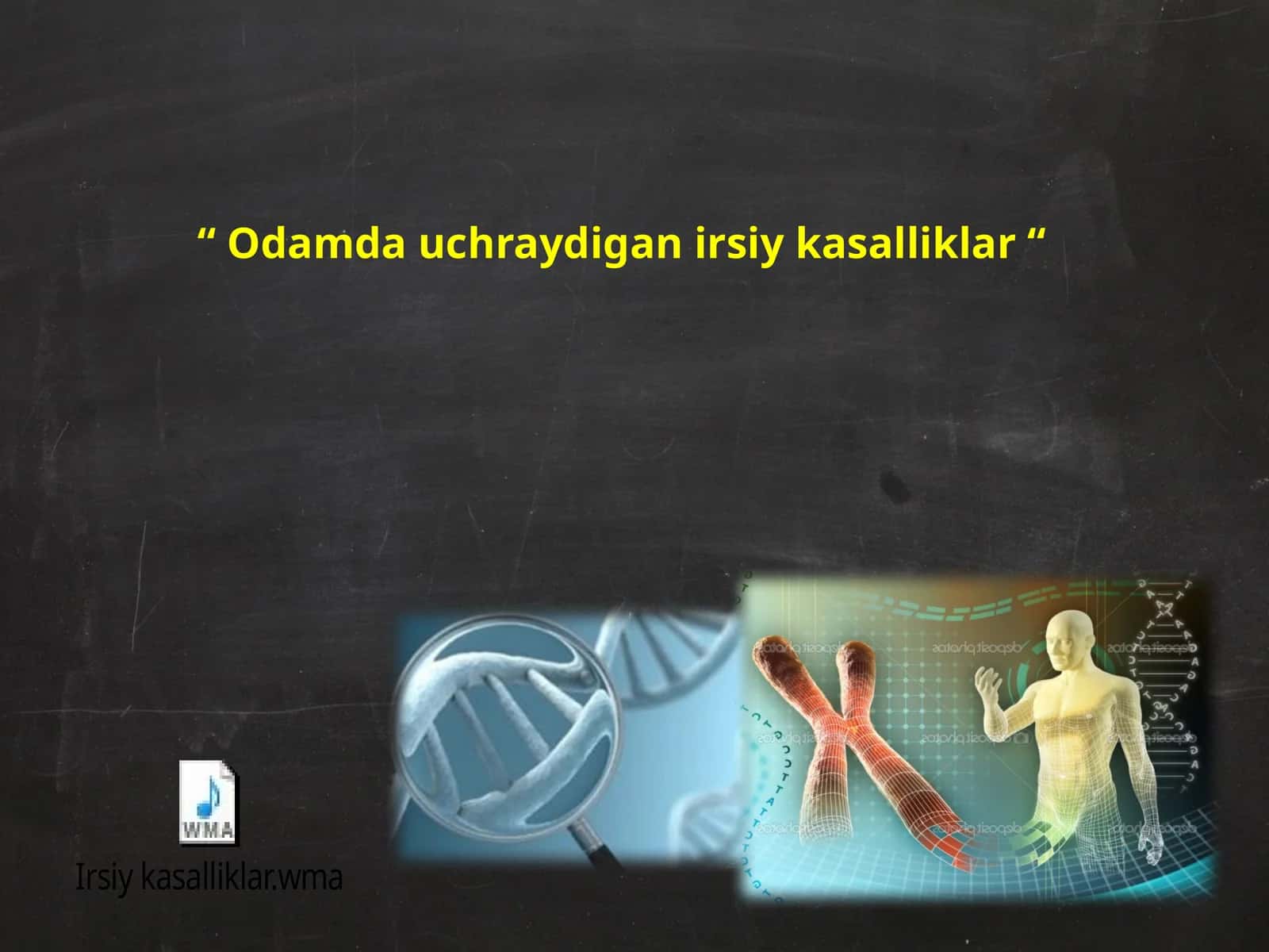 Odamda uchraydigan irsiy kasalliklar