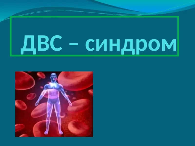 Микроциркулятор узан тромбози ёки коннинг куплаб томирлар ичида ивиб колиш синдроми