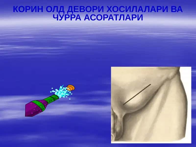 КОРИН ОЛД ДЕВОРИ ХОСИЛАЛАРИ ВА ЧУРРА АСОРАТЛАРИ