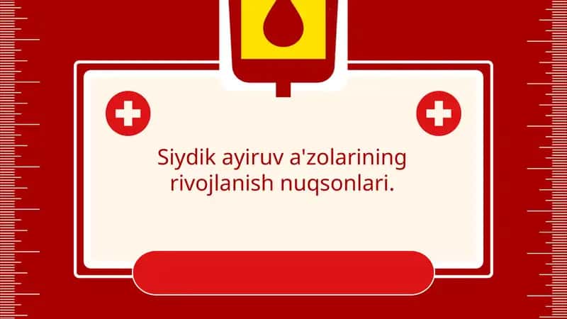 Siydik ayiruv a'zolarining rivojlanish nuqsonlari