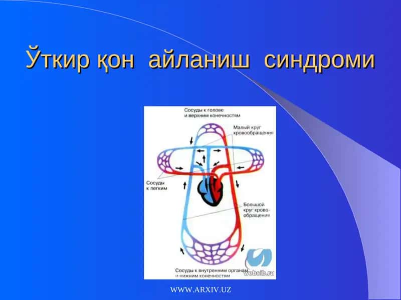 Ўткир қон айланиш синдроми