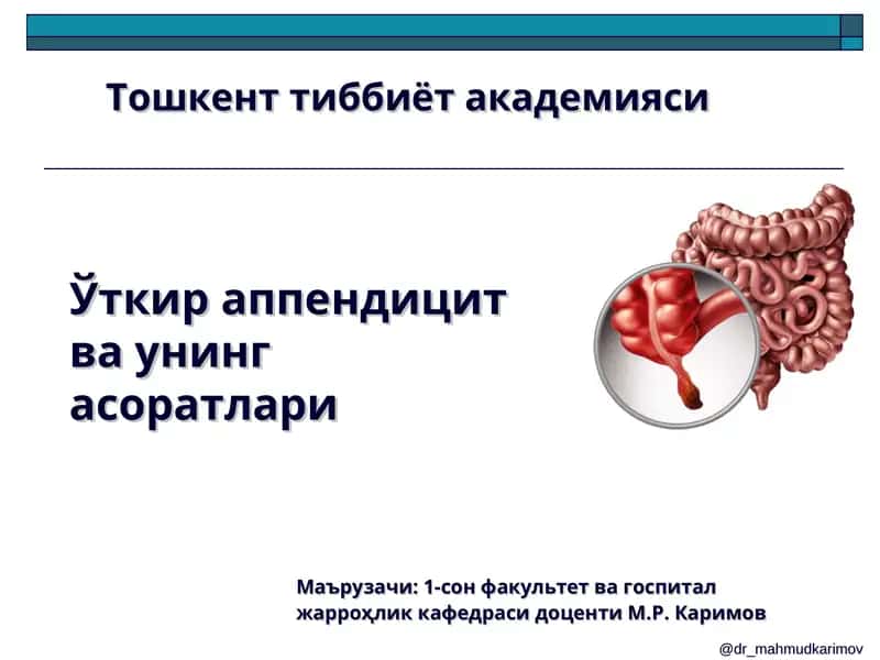 Ўткир аппендицит ва унинг асоратлари