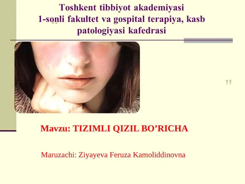 TIZIMLI QIZIL BO’RICHA