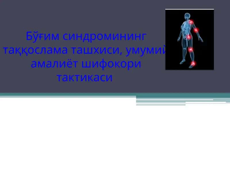Бўғим синдроми
