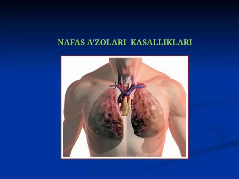 NAFAS A'ZOLARI KASALLIKLARI