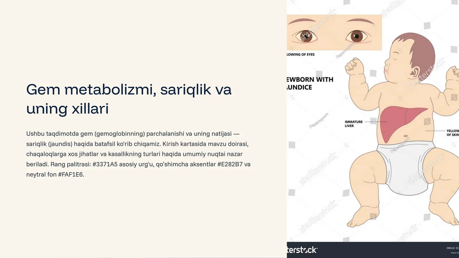 Gem metabolizmi, sariqlik va uning xillari