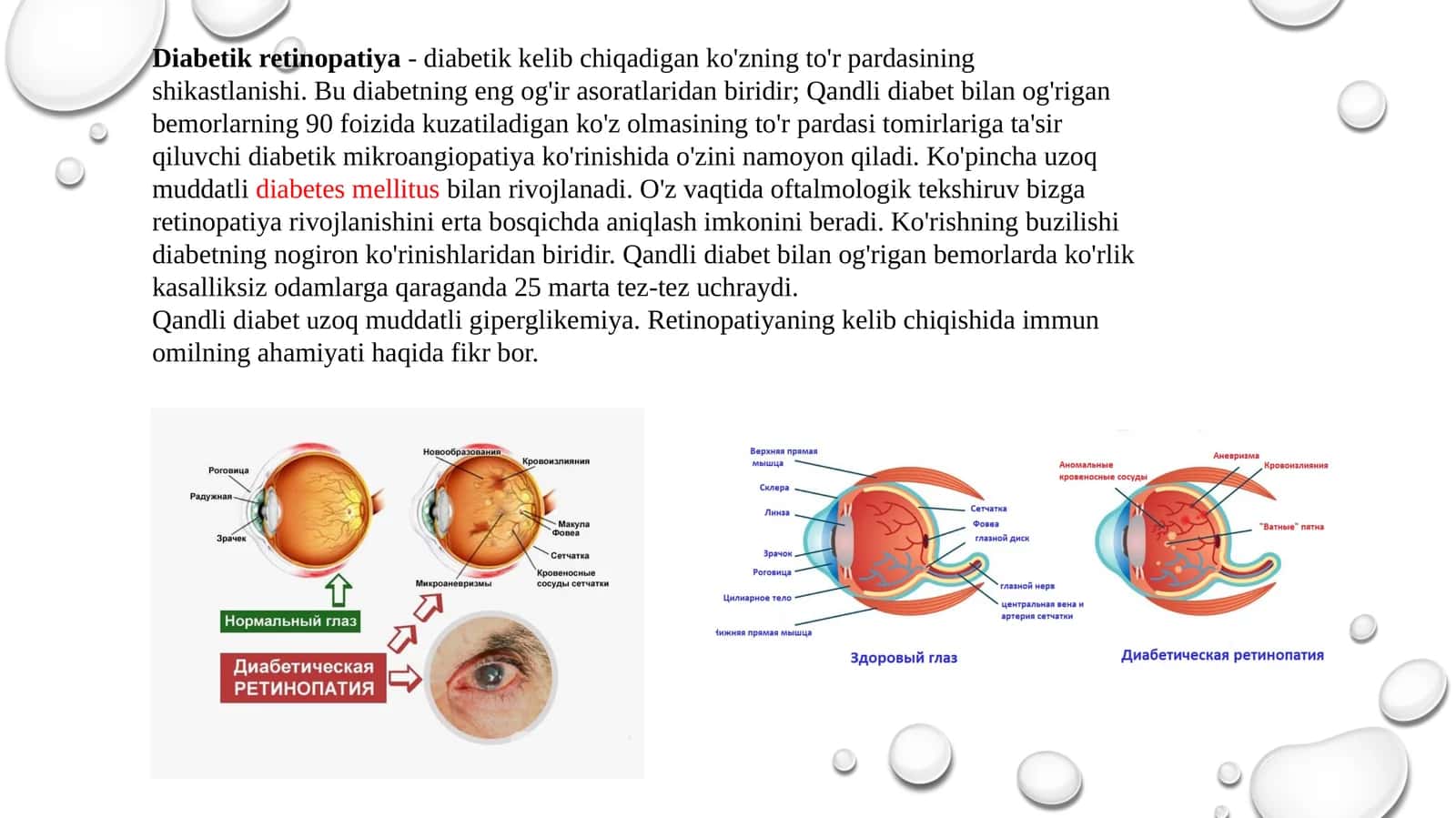 Diabetik retinopatiya