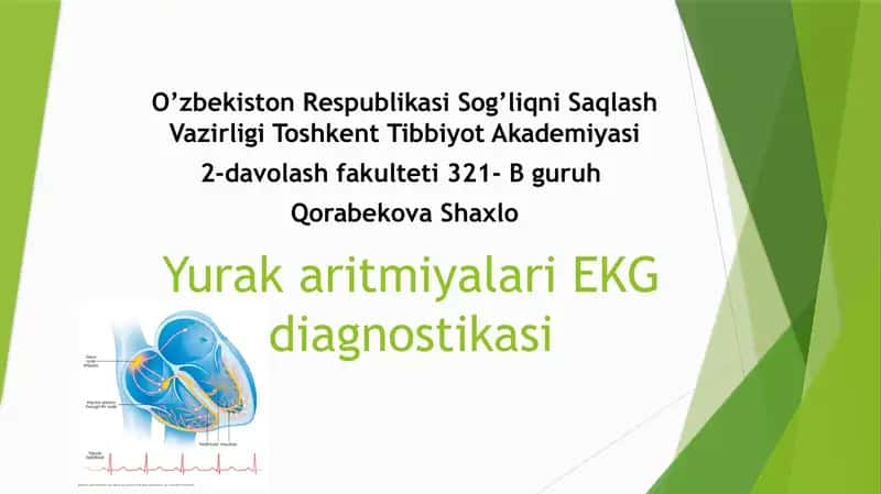 YurakaritmiyalariEKG diagnostikasi