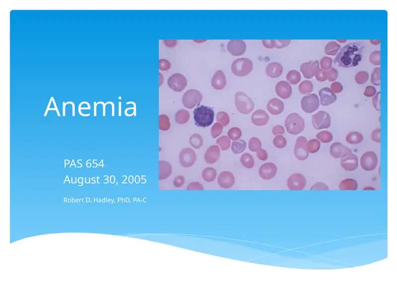 Anemia