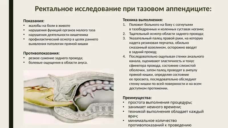 Ректальное исследование