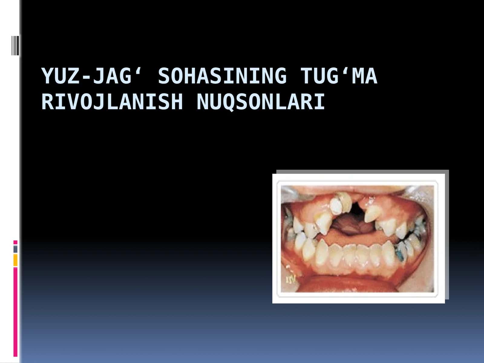 YUZ-JAG‘ SOHASINING TUG‘MA NUQSONLARI xirurgiyasi