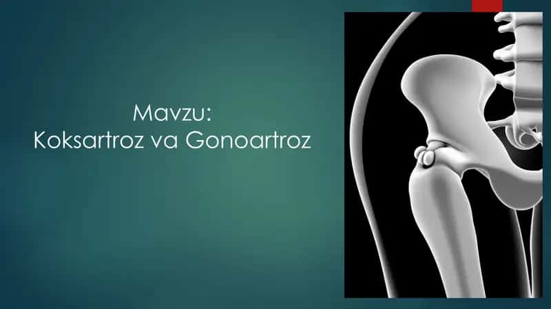 Koksartroz va gonoartroz