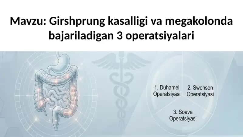 Girshprung kasalligi va megakolonda bajariladigan 3 operatsiyalar
