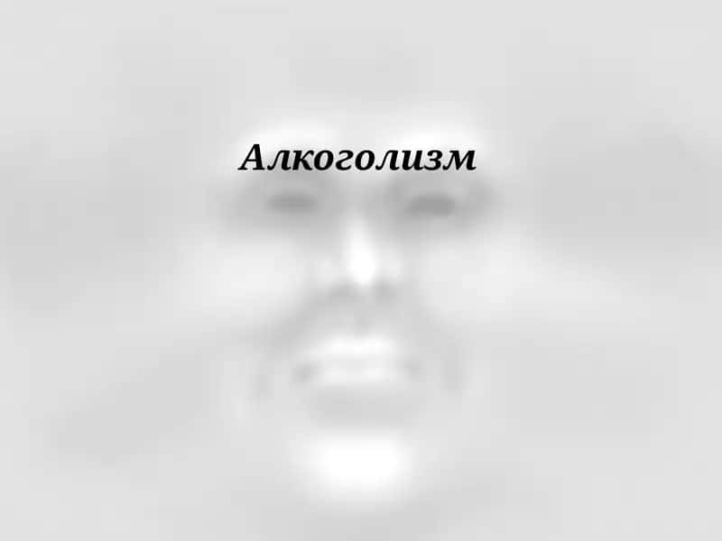 Алкоголизм . Alkogolizm slayd mustaqil ish