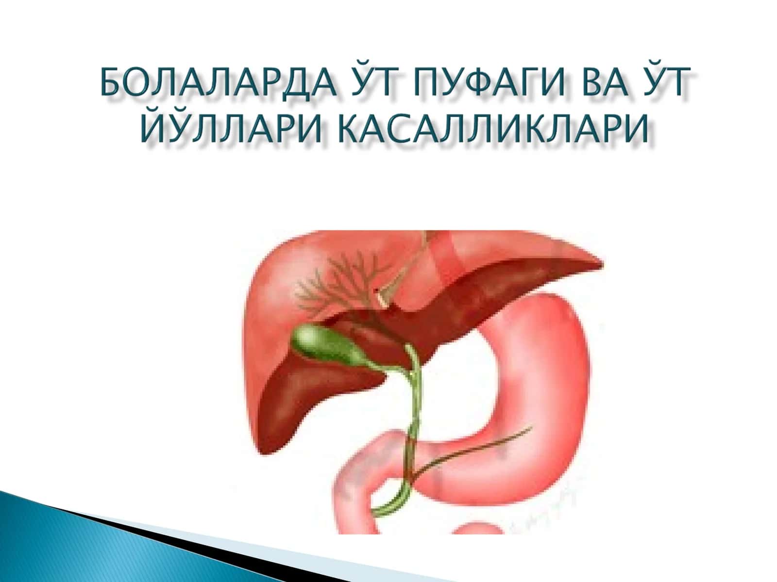 Холецистит