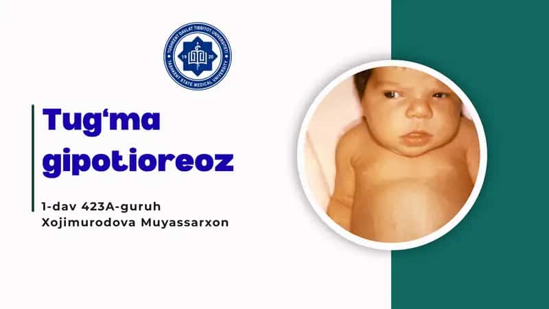 Tug‘ma gipotioreoz
