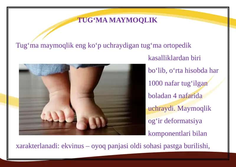 Tug‘ma maymoqlik