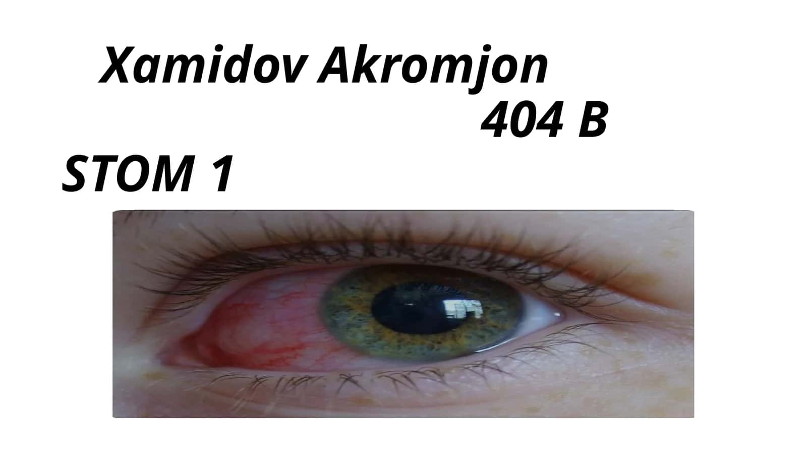 Virusli konyuktivit