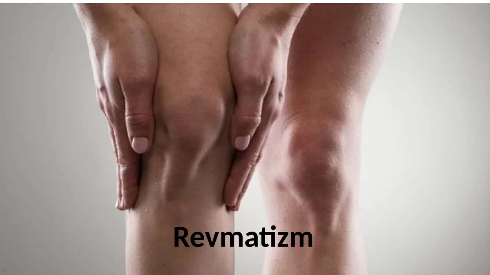 Revmatizm nima. Kasallik haqida umumiy ma’lumot