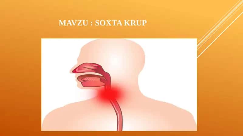 Soxta krup