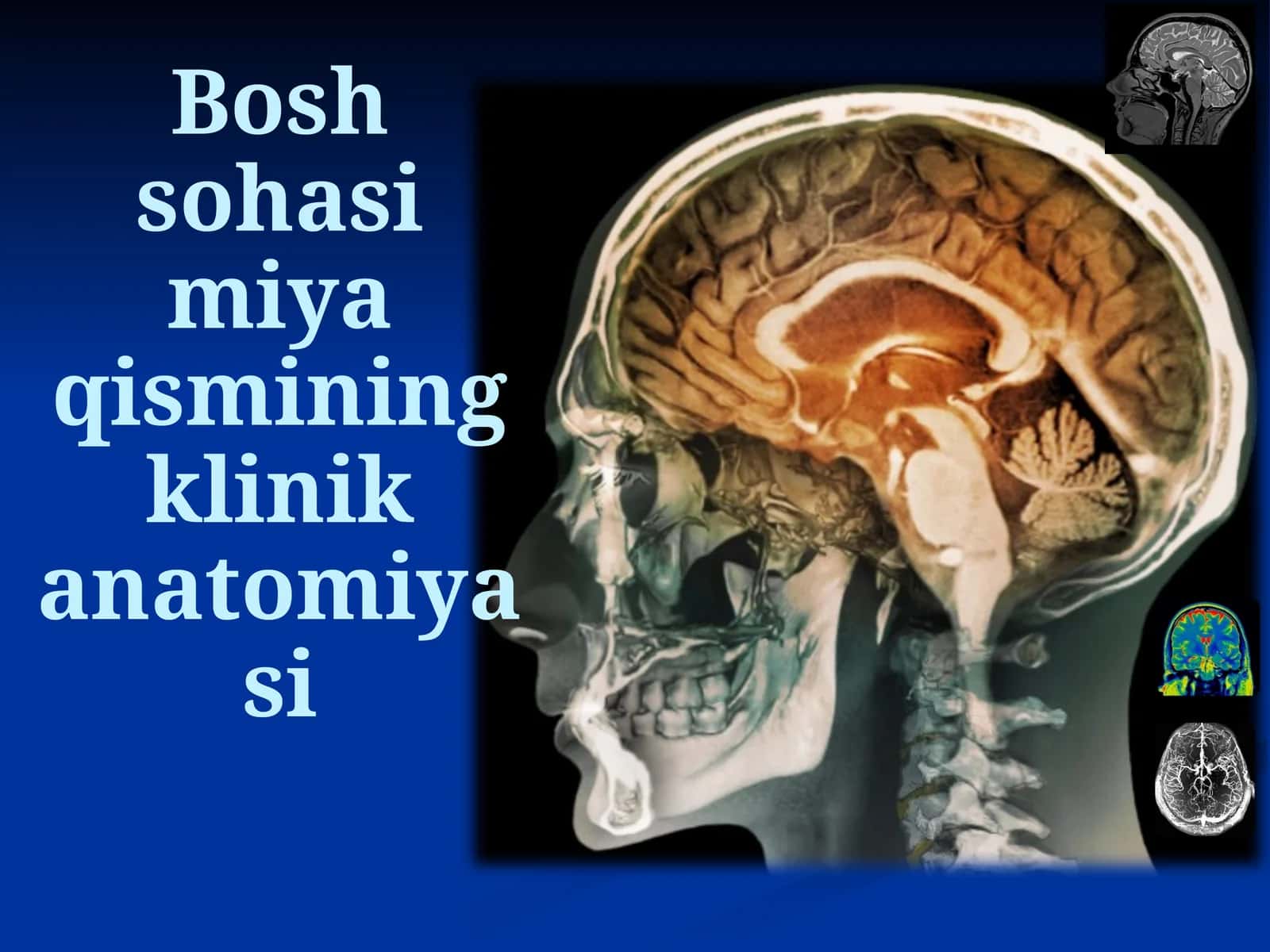 Bosh sohasi miya qismining klinik anatomiyasi