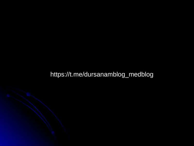 НУР ТАШХИСИ УСУЛЛАРИ