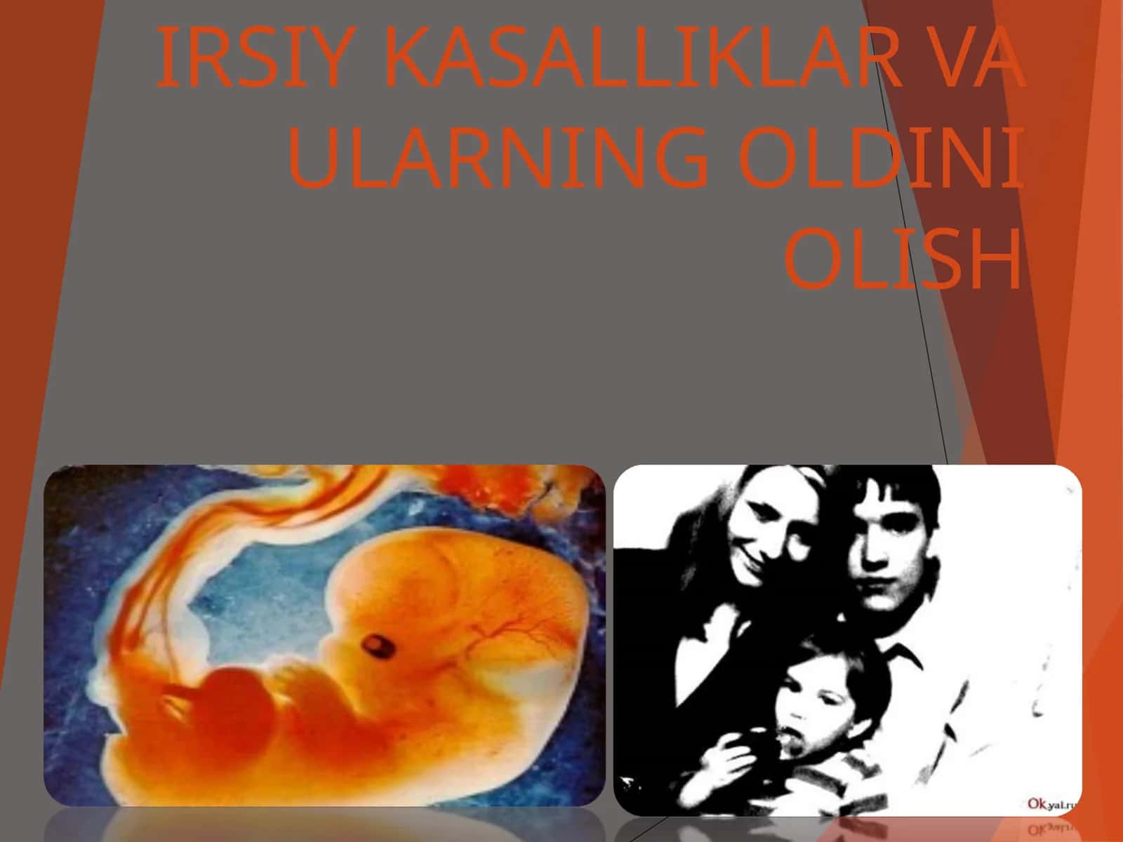 IRSIY KASALLIKLAR VA ULARNING OLDINI OLISH