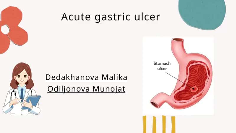Gastric ulcer