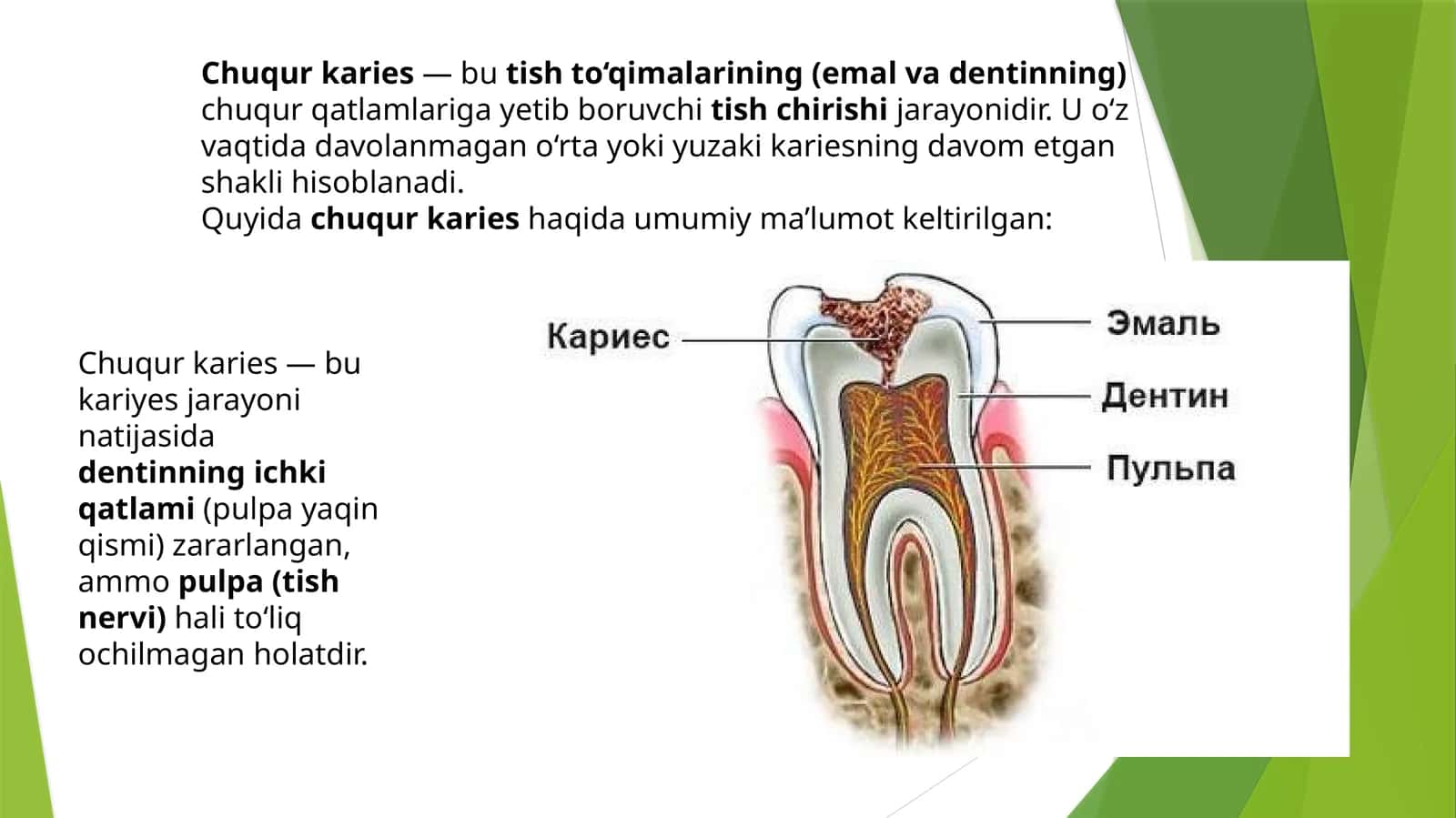 Chuqurkaries