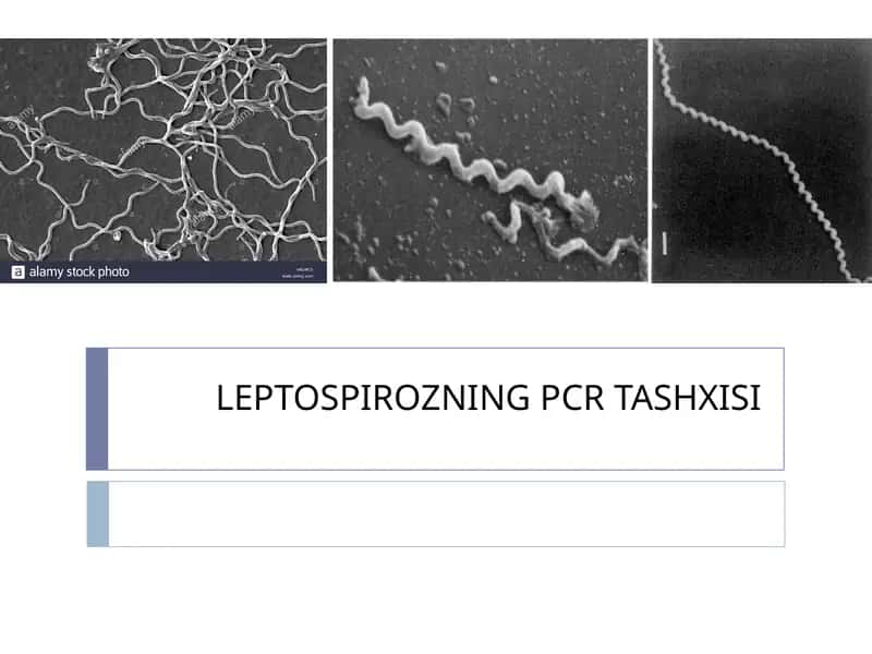 LEPTOSPIROZNING PCR TASHXISI
