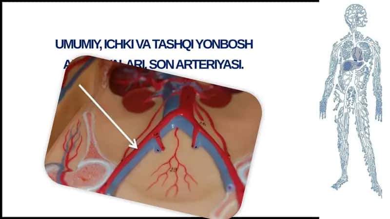 Umumiyyon bosh arteriyasi