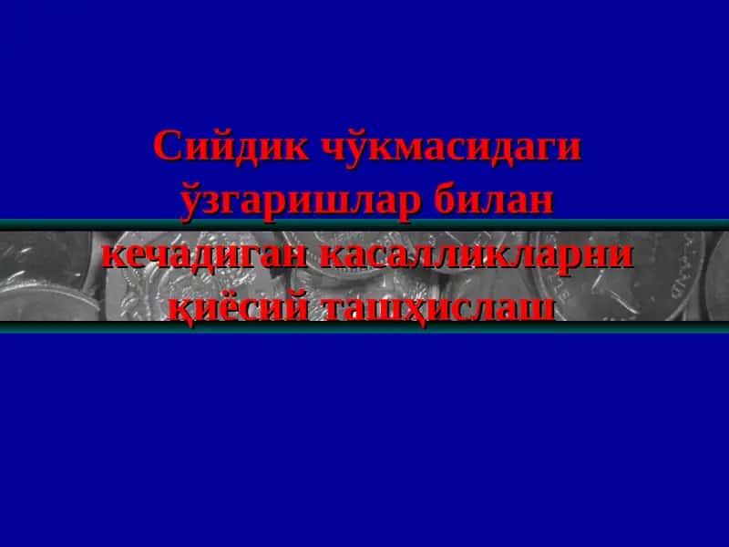 Siydik cho'kmasi