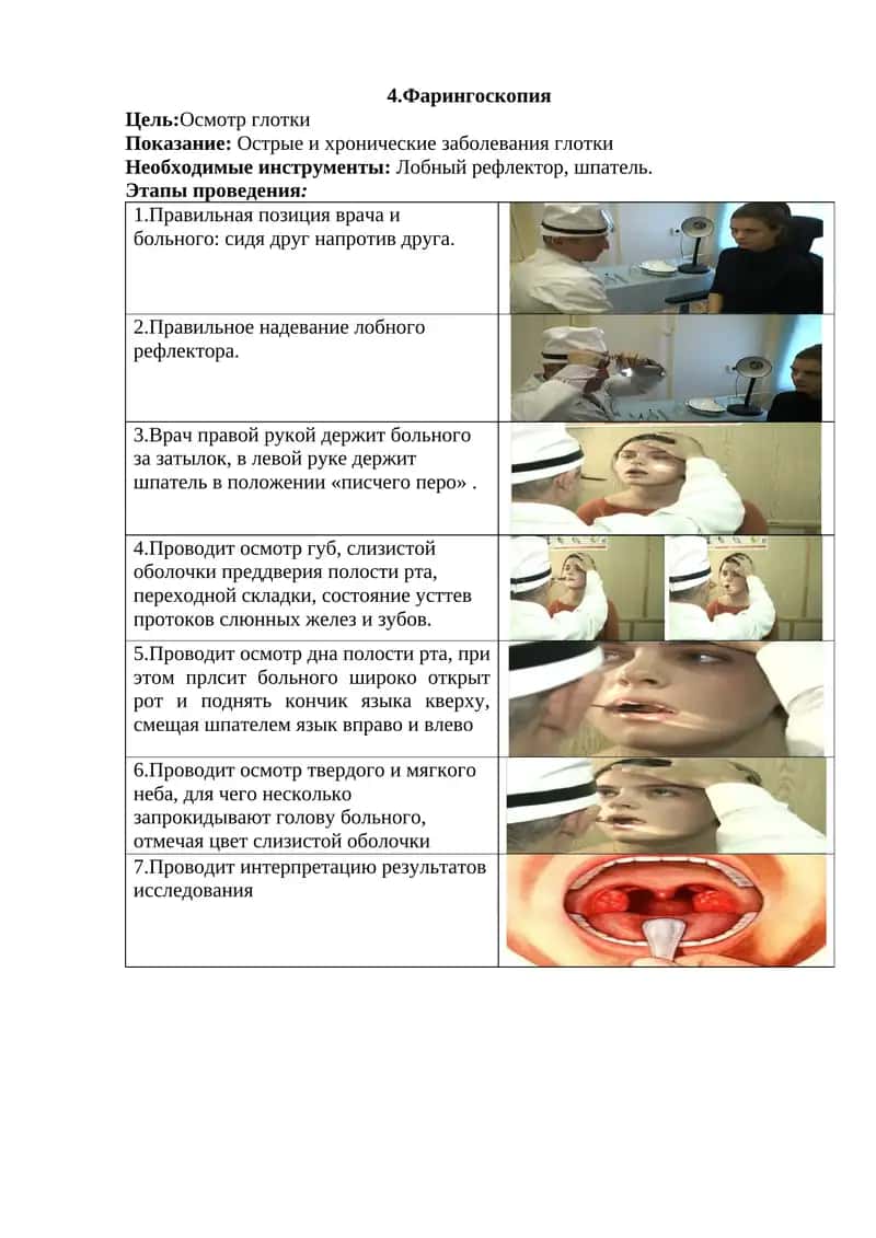 Фарингоскопия